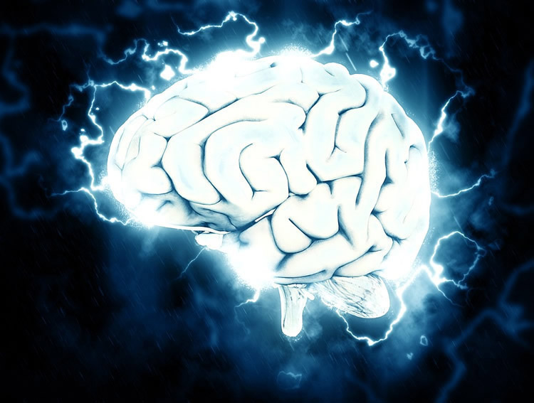 epilepsy-brain-rewiring